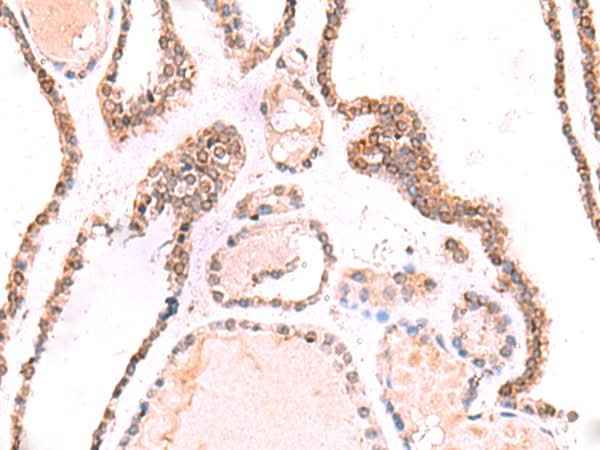 Anti-Human/Mouse/Rat TOR1AIP1 Antibody