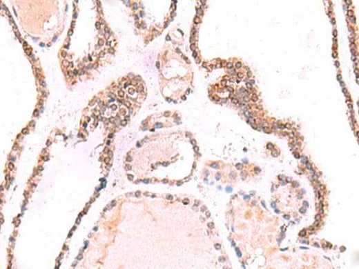 Anti-Human/Mouse/Rat TOR1AIP1 Antibody