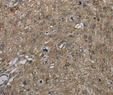 Anti-Human CLPS Antibody