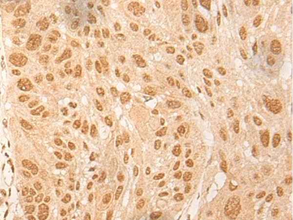 Anti-Human/Mouse/Rat DBP Antibody
