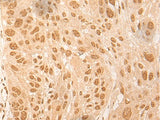 Anti-Human/Mouse/Rat DBP Antibody - ABMIUM