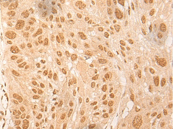 Anti-Human/Mouse/Rat DBP Antibody - ABMIUM