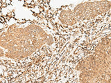 Anti-Human/Mouse/Rat FER Antibody - ABMIUM