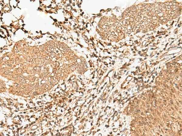 Anti-Human/Mouse/Rat FER Antibody