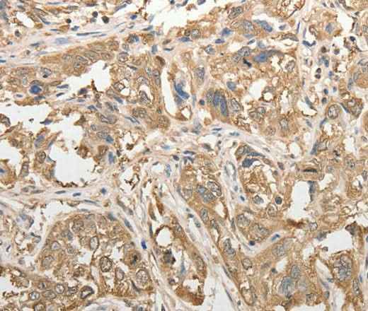 Anti-Human/Mouse/Rat ADHFE1 Antibody