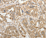 Anti-Human/Mouse/Rat ADHFE1 Antibody - ABMIUM