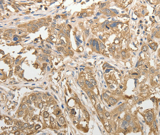 Anti-Human/Mouse/Rat ADHFE1 Antibody - ABMIUM