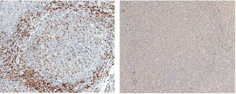 Anti-Human CD3D Antibody [A961] - ABMIUM