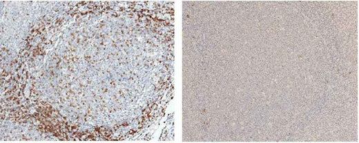 Anti-Human CD3D Antibody [A961] - ABMIUM