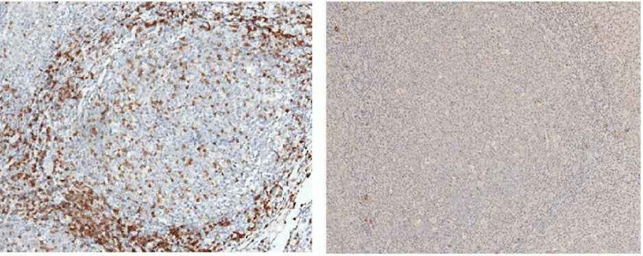 Anti-Human CD3D Antibody [A961] - ABMIUM