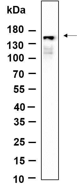 Anti-Human/Mouse/Rat PLCγ1 Antibody [B1157] - ABMIUM