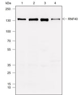 Anti-Human RNF40 Antibody [A775] - ABMIUM
