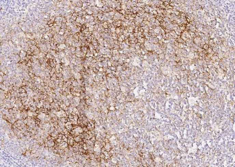 Anti-Human CD14 Antibody [A941] - ABMIUM