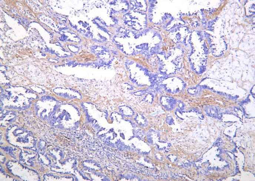 Anti-Human/Mouse/Rat SREBP-1 Antibody [B1165] - ABMIUM