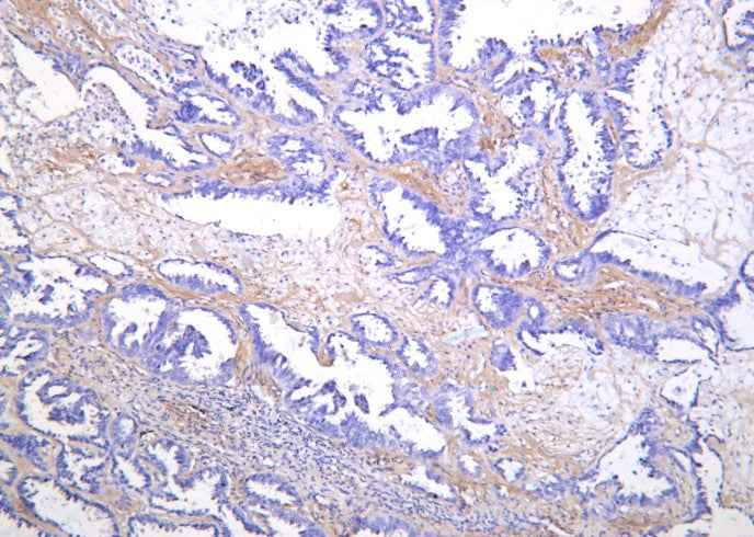Anti-Human/Mouse/Rat SREBP-1 Antibody [B1165]