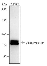 Anti-Human/Rat/Mouse Caldesmon/CDM Antibody [A147]