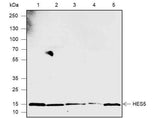 Anti-Human/Rat/Mouse HES5 Antibody [A570]
