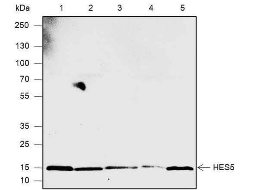 Anti-Human/Rat/Mouse HES5 Antibody [A570] - ABMIUM