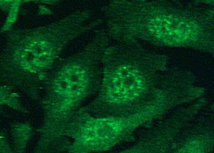Anti-Human HIF1A Antibody [B335] - ABMIUM