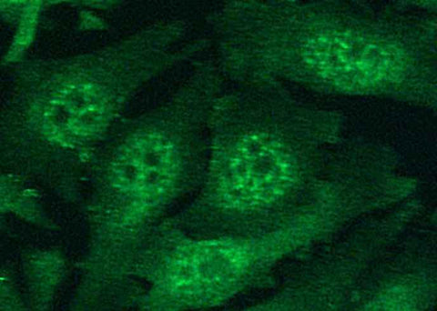 Anti-Human HIF1A Antibody [B335] - ABMIUM