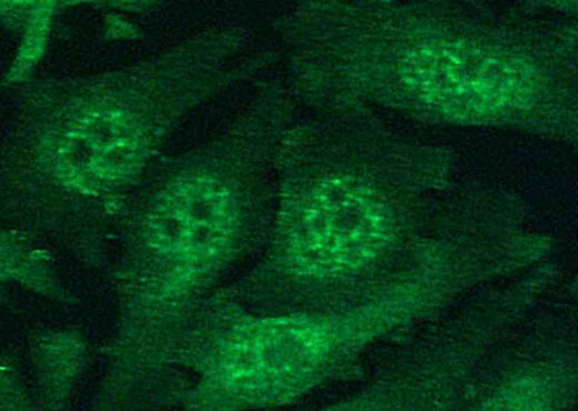 Anti-Human HIF1A Antibody [B335] - ABMIUM
