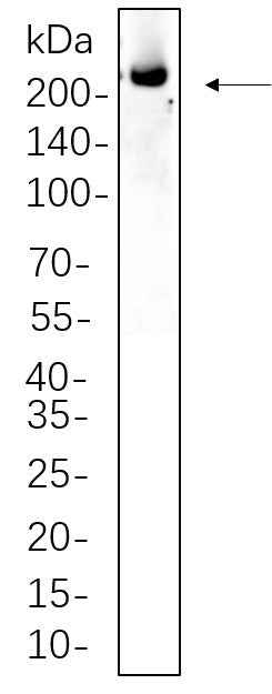 Anti-Human ALK Antibody [B1125] - ABMIUM