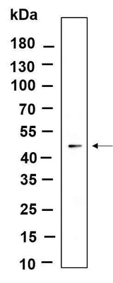 Anti-Human/Mouse/Rat ILK Antibody [B930]