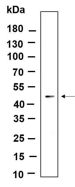 Anti-Human/Mouse/Rat ILK Antibody [B930] - ABMIUM