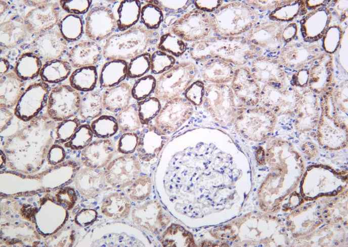 Anti-Human/Mouse/Rat Cyclophilin F Antibody [B1026] - ABMIUM