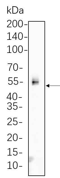 Anti-Human/Mouse/Rat Chk1 Antibody [B1087] - ABMIUM