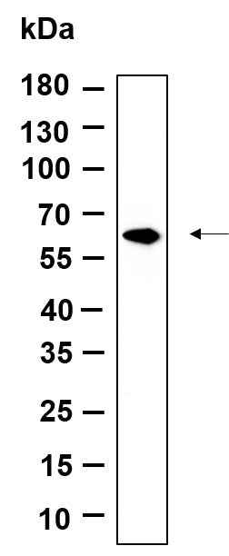 Anti-Human/Mouse/Rat FPGS Antibody [B1005] - ABMIUM