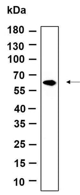 Anti-Human/Mouse/Rat FPGS Antibody [B1005]