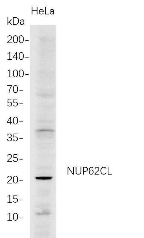Anti-Human NUP62CL Antibody [B688] - ABMIUM