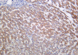 Anti-Human/Mouse/Rat Inhibin β-E Antibody [B1171]