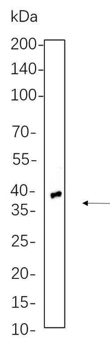 Anti-Human/Mouse/Rat TTF1 Antibody [B582]