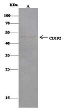 Anti-Human CCR2 Antibody - ABMIUM