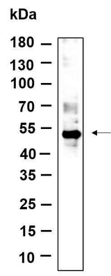 Anti-Human/Mouse p53 Antibody [B895]