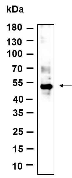 Anti-Human/Mouse p53 Antibody [B895] - ABMIUM