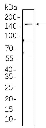 Anti-Human/Mouse/Rat LATS1 Antibody [B734]