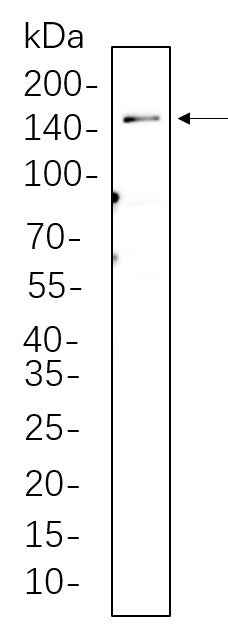 Anti-Human/Mouse/Rat LATS1 Antibody [B734] - ABMIUM