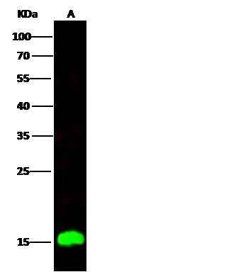 Anti-Human C1D Antibody [B172] - ABMIUM