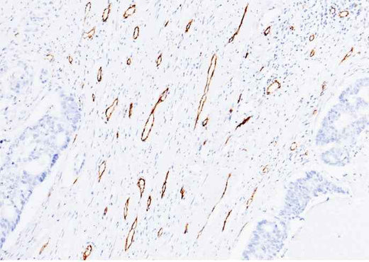 Anti-Human PECAM1 Antibody [B226] - ABMIUM