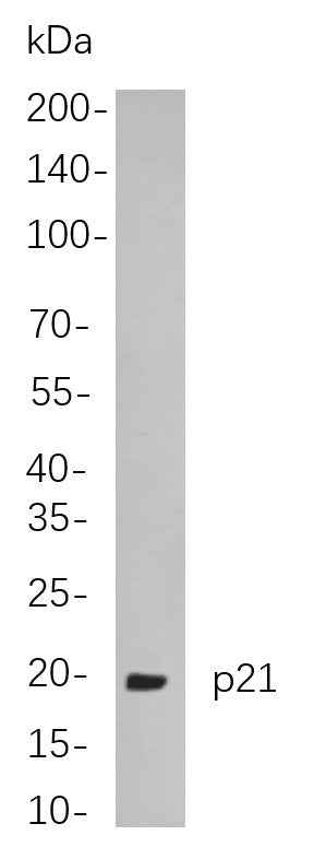 Anti-Human/Rat P21 Antibody [B778] - ABMIUM