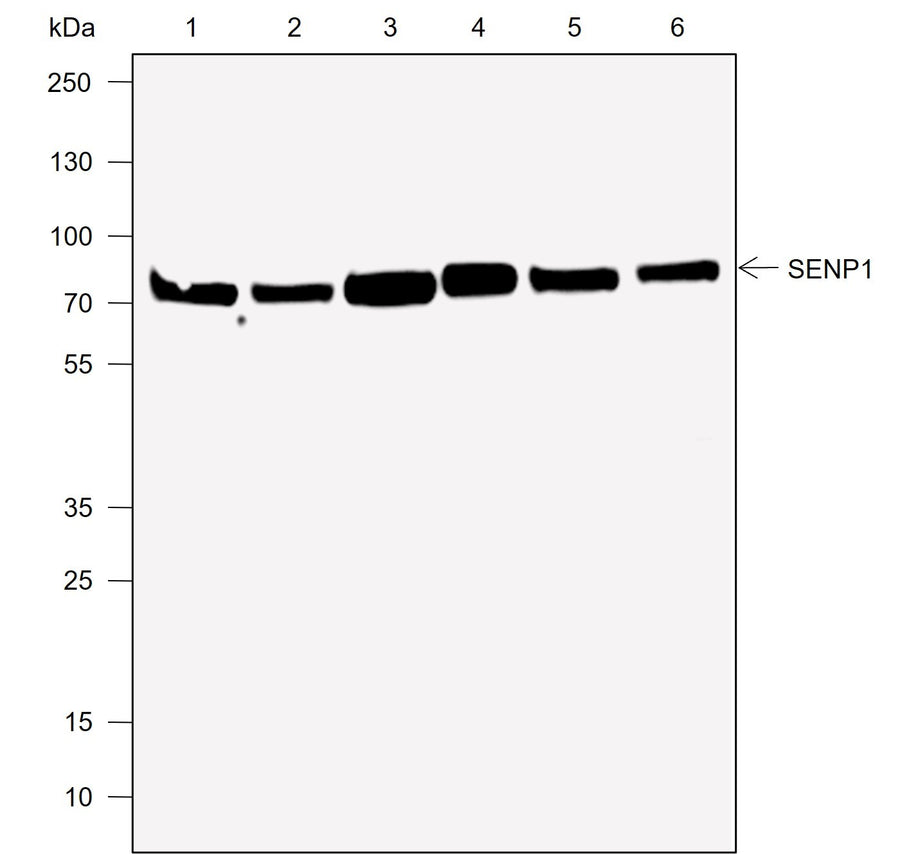 Anti-Human/Rat/Mouse SENP1 Antibody [A722] - ABMIUM