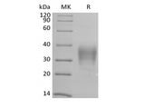 Recombinant Human CD79B/B29 (C-6His-Avi) Biotinylated - ABMIUM