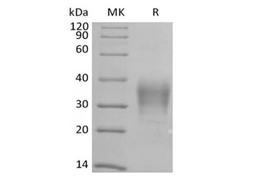 Recombinant Human CD79B/B29 (C-6His-Avi) Biotinylated - ABMIUM