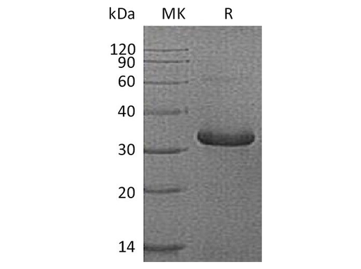 Recombinant Human IGFBP-1/IGFBP1 Protein (His Tag) - ABMIUM