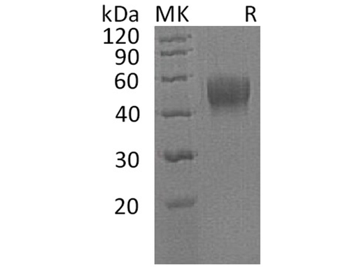 Recombinant Human IL10RB/IL10R2 Protein (His Tag) - ABMIUM