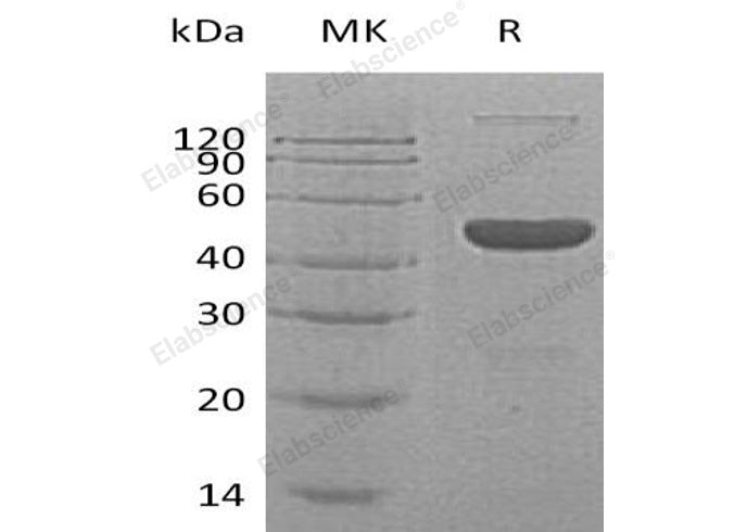 Recombinant Human GABA Protein (His & FcTag) - ABMIUM