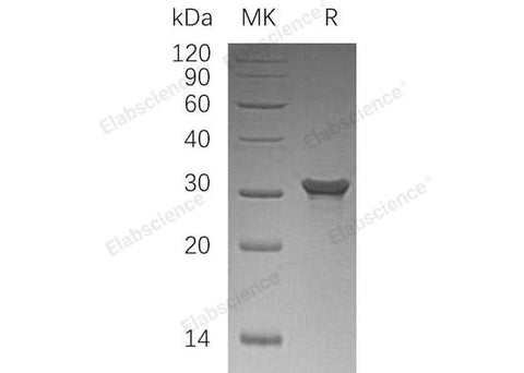 Recombinant Human PAFAH1B2/PAFAHB Protein (His Tag) - ABMIUM